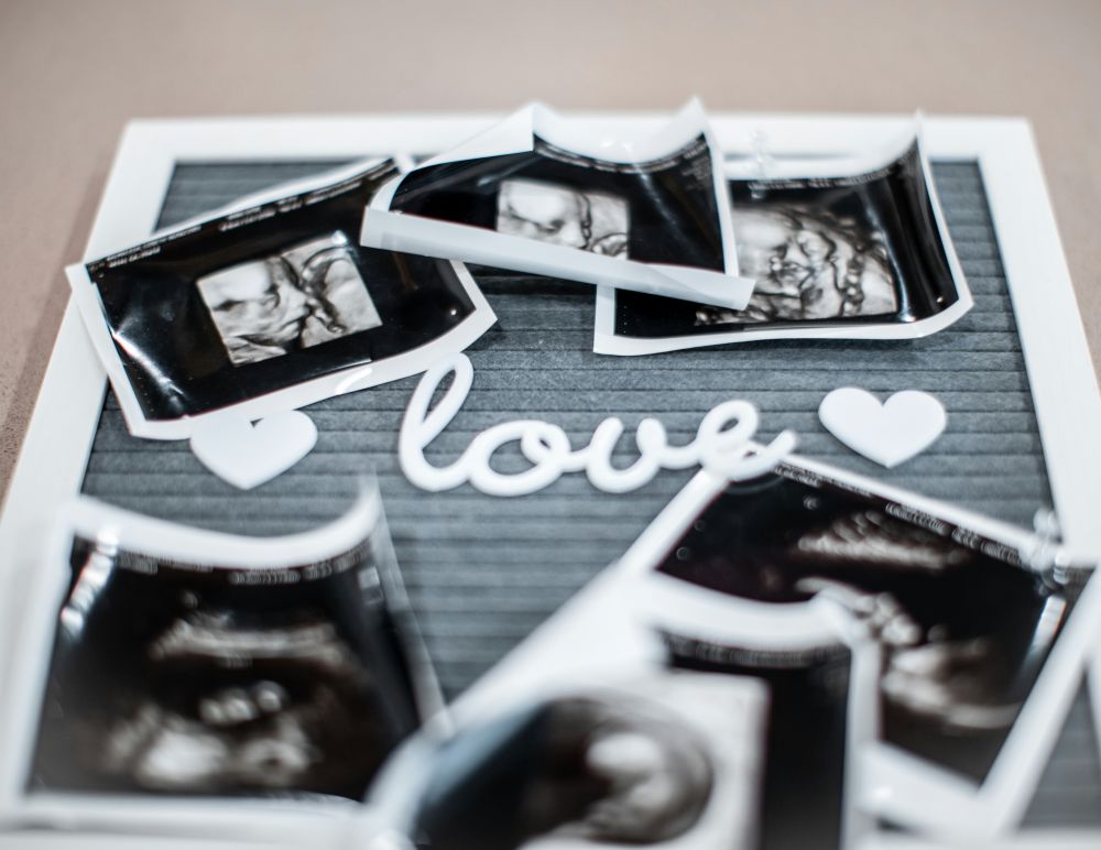 Nipt test  vad du behöver veta om tidig fosterdiagnostik